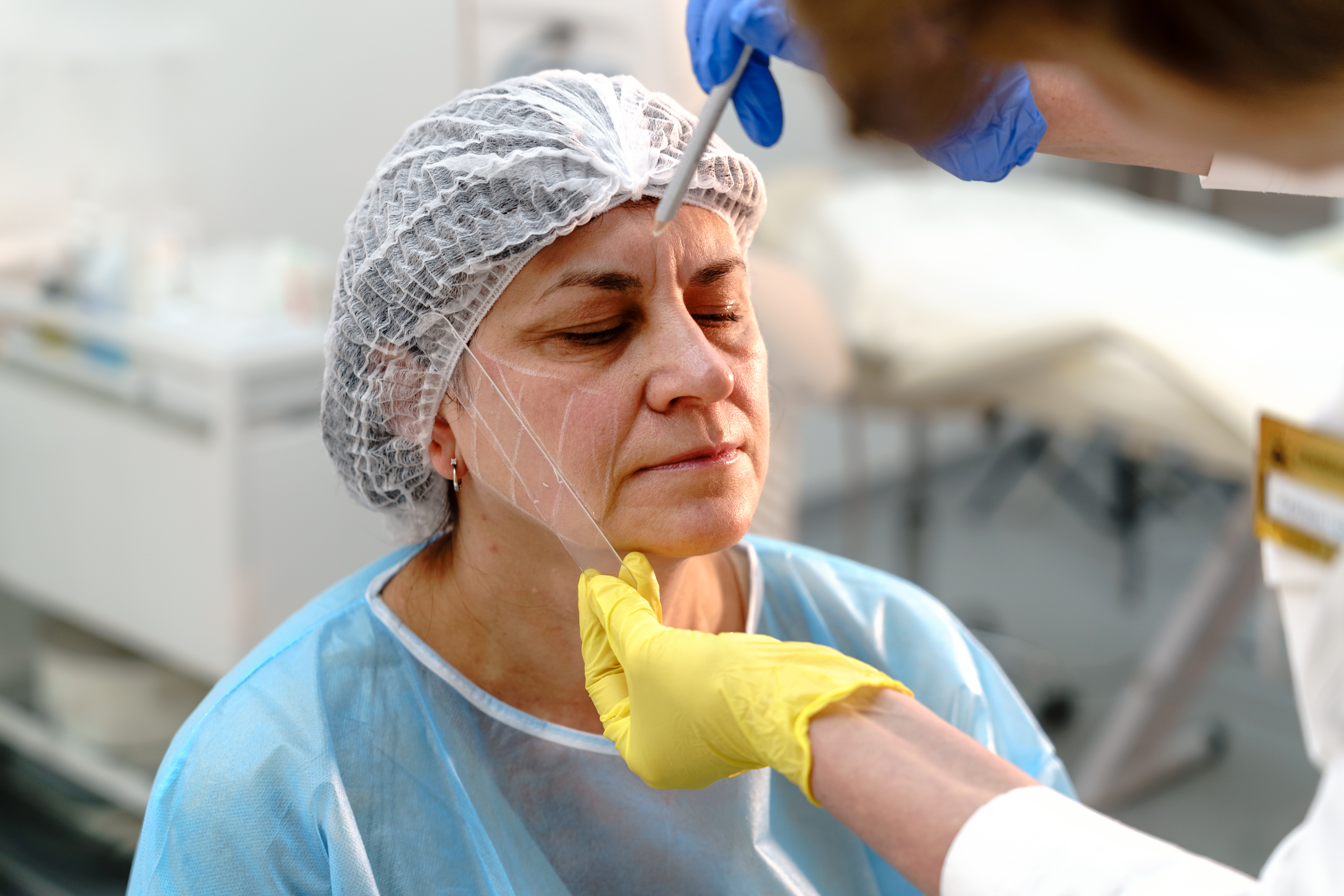 Venda irresponsável de botox mascara doenças e coloca a saúde de pacientes em risco 